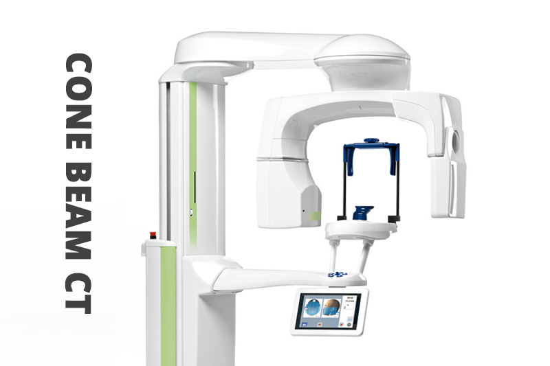 Cone Beam CT Imaging in Tucson