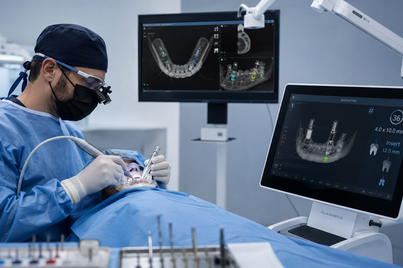 Computer-guided dental implant surgery in Tucson