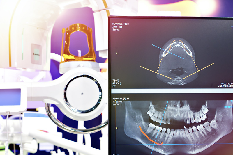 Digital X-Rays in Tucson